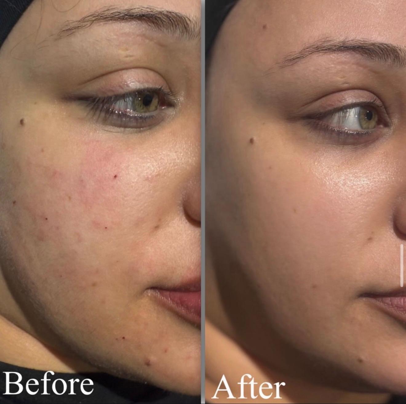 Clinic-supplied comparison photograph showing skin appearance, example 4